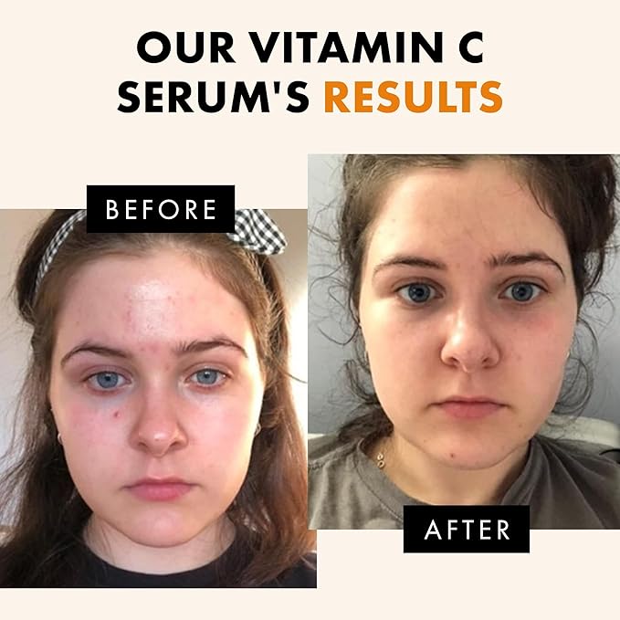 Eclat Skincare Vitamin C Face Serum - Skin Care for Dark Spots, Vitamin C Serum with Hyaluronic Acid, Ferulic Acid, & Vit E - Anti Aging and Skin Brightening, Pure Vit C Facial Care - 30 ml