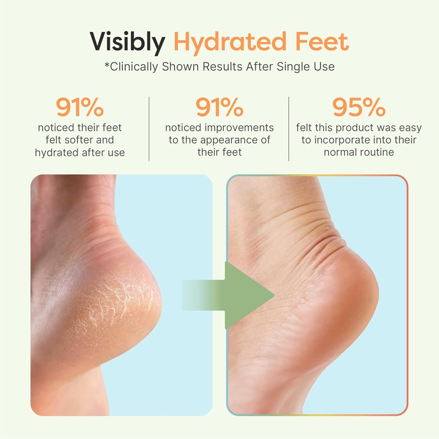 ZenToes Moisturizing Socks for Cracked Heel Treatment - Vitamin E, Olive Oil and Jojoba Oil Infused Heel Socks to Soften and Hydrate (Yellow & White Daisies, Regular)