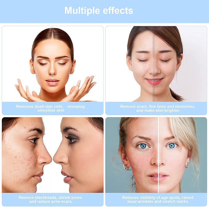 3 in 1 Diamond Dermabrasion Machine Professional Pore Vacuum for Skin Toning Black Head Removal Cleaner with 0-70 cmHg Suction Power Facial Treatment Machine