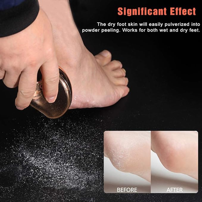 BEZOX Glass Foot File Callus Remover, Crystal Pedicure Foot Scrubber for Travel Use, Portable Handheld Sized Foot Scraper for Cracked Heel - Shinning Golden