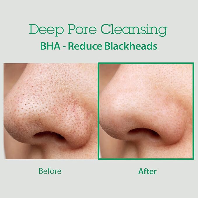 BLITHE AHA BHA Cleanser - Deep Pore Cleanser and Pore Minimizer, Exfoliant for Face, For Clogged Pores, 5.07 Fl Oz
